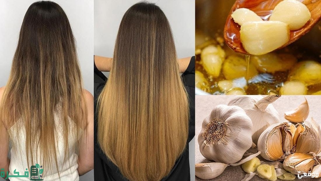 فوائد الشعر للثوم
