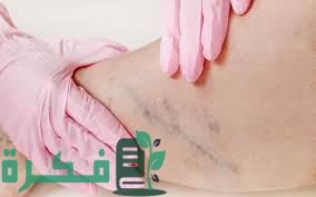 5D8D2D42 F75D 43EE 855A 00891AD293A4