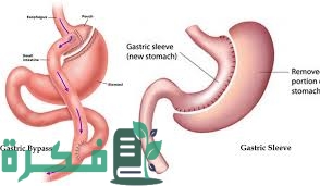 6A0ACA7B 1127 4BCF BEC7 27ED69461F6E