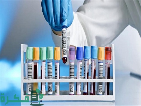 كيف يمكن تقنين مصاريف معمل تحاليل