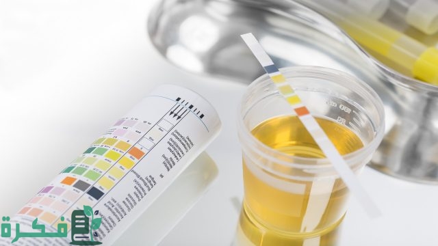 علاج اصفرار البول