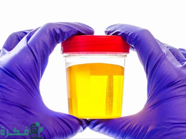 علاج اصفرار البول