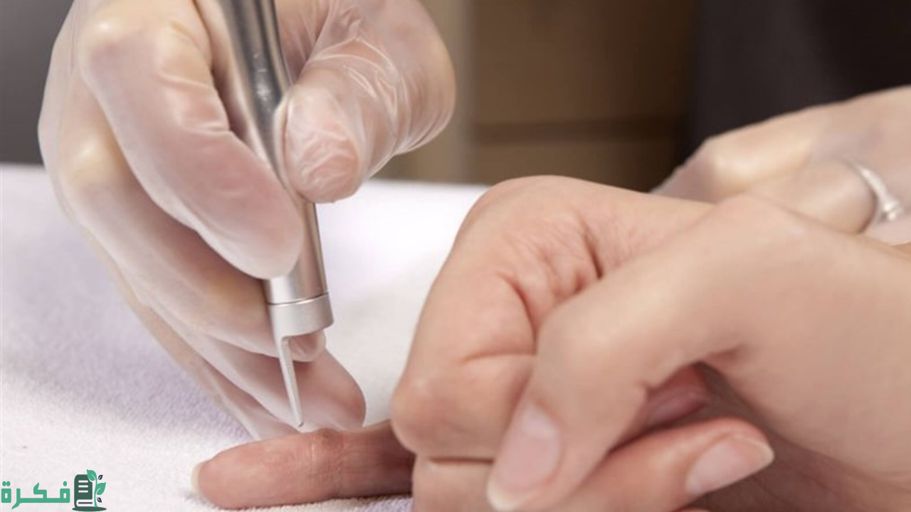 كيف تعالج جروح الكي 7 طريقة علاج جروح الكي 2