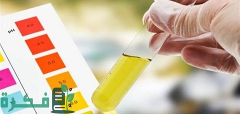 ما معنى Hazy في تحليل البول 4 ما معنى Hazy في تحليل البول