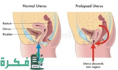 images 2022 11 22T233249.573