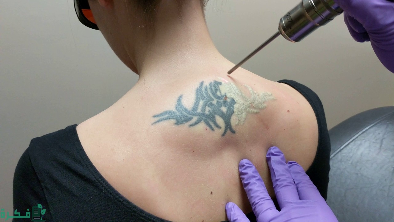 عيادات تسوي تاتو جسم في الرياض