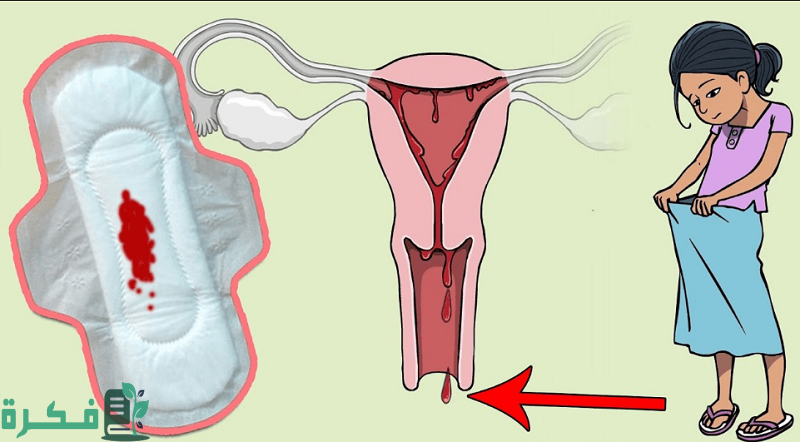 أسباب استمرار الدورة الشهرية أكثر من 15 يوم