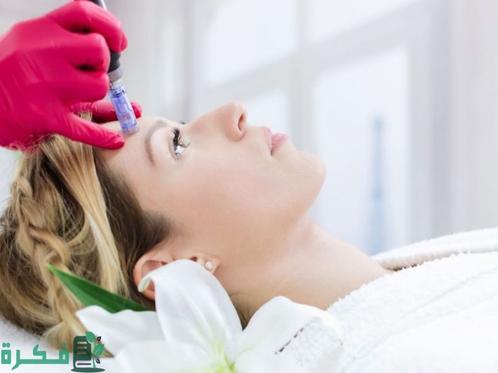 اسمرار الوجه بعد الديرما بن