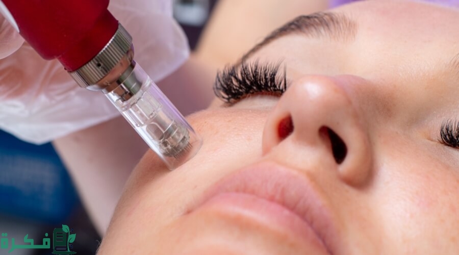 اسمرار الوجه بعد الديرما بن