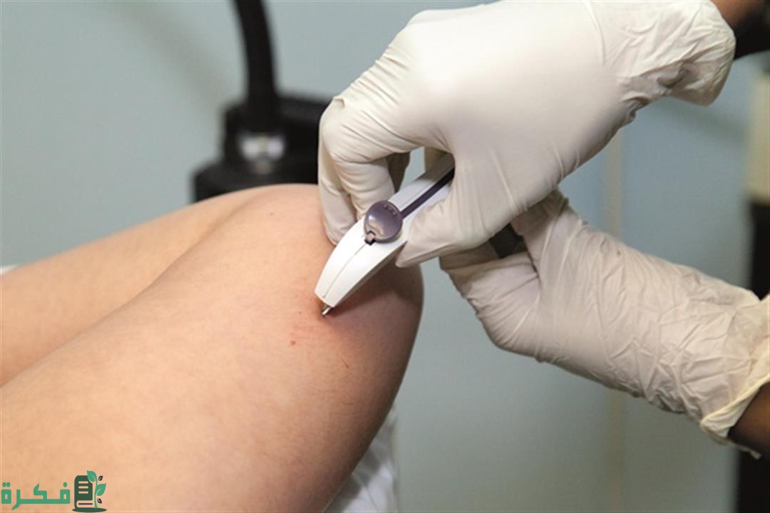 تجربتي مع شريحة منع الحمل