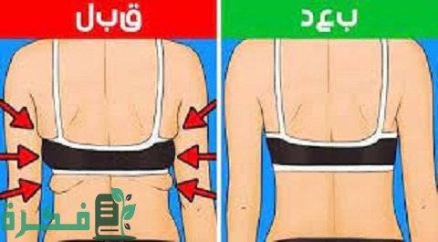 تراكم الدهون بسبب حمالة الصدر