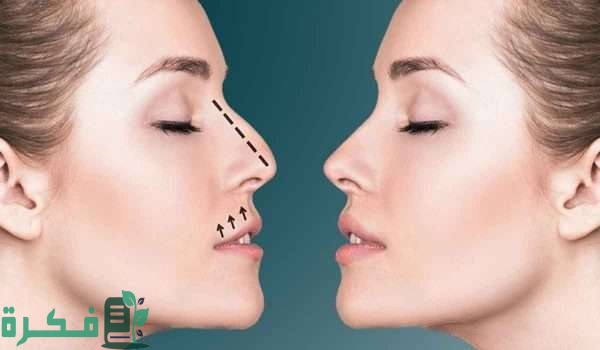 تكلفة عملية تجميل الانف في الرياض