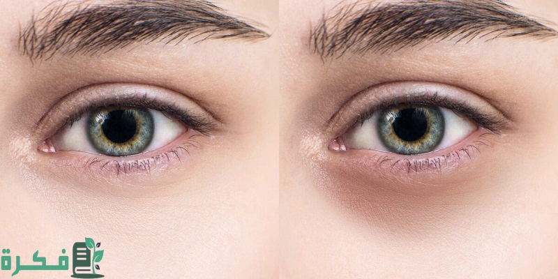 شحم الخروف للتجاعيد والهالات السوداء