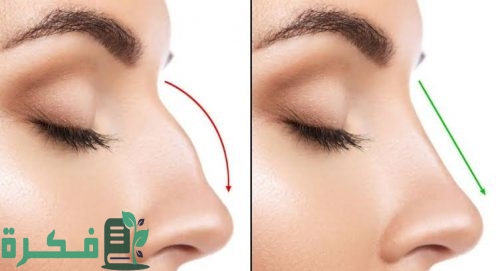 عملية تجميل الأنف بالليزر