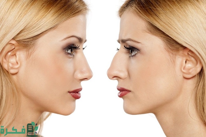 عملية تجميل الأنف جدة