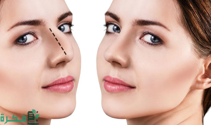 عملية تجميل الأنف جدة