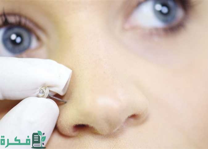 متى أشيل الحلق الطبي من الأنف