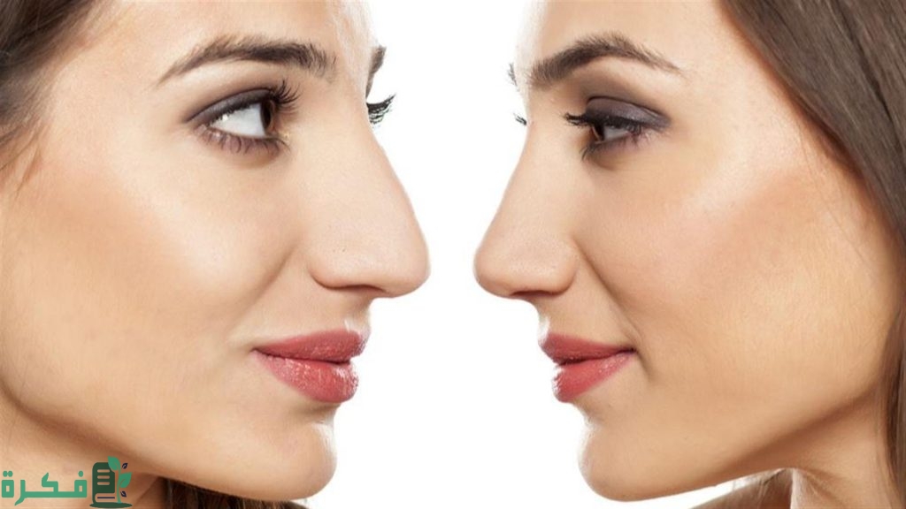 كم تكلف عملية تجميل الأنف