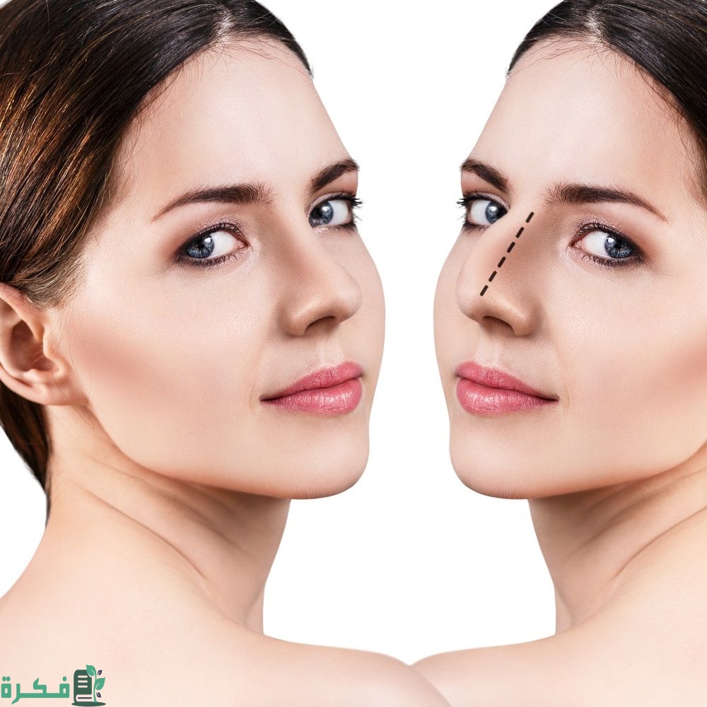 كم تكلفة عملية تجميل الأنف في مستشفى الحبيب