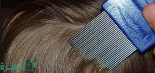 أفضل 5 طرق لعلاج القمل عند الأطفال