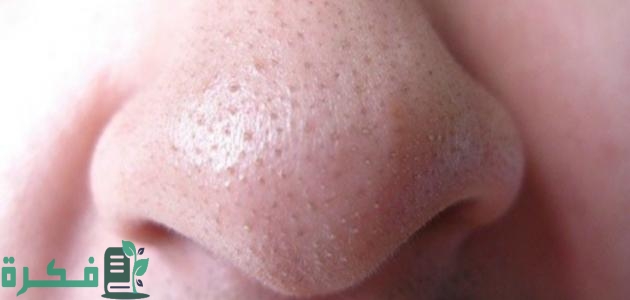 خطوات استخدام لصقات نيفيا لإزالة الرؤوس السوداء