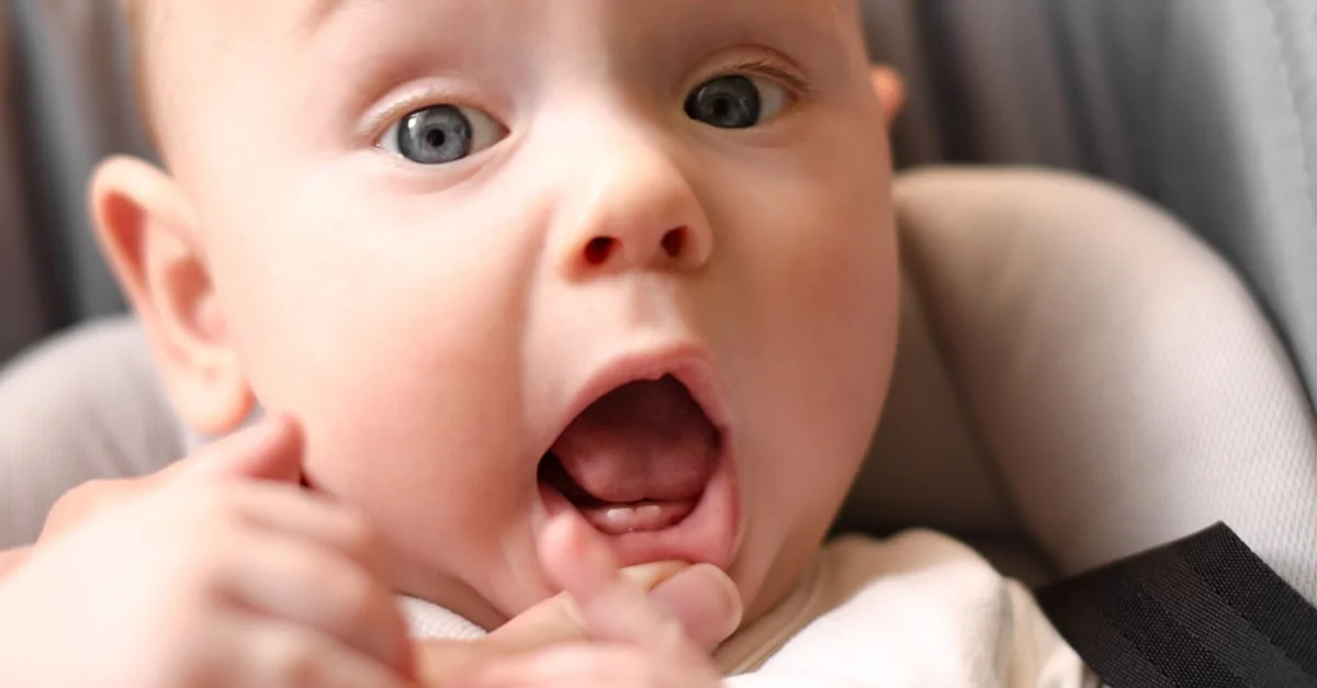 أسباب تأخر التسنين عند الرضع