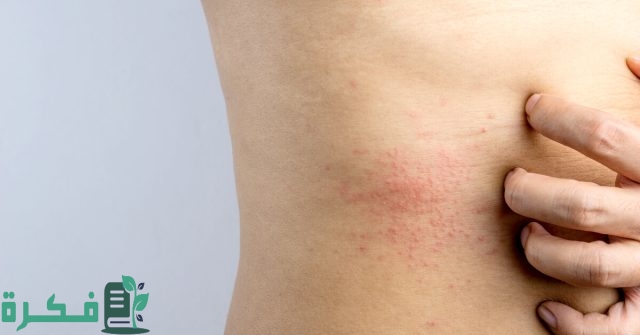 ظهور حبوب في الجسم أثناء الحمل وجنس الجنين