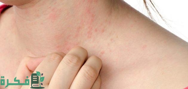 علاج حساسية الجلد من التراب