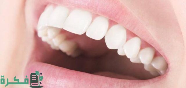 كم سعر ابتسامة هوليود في مصر كم سعر ابتسامة هوليود في مصر