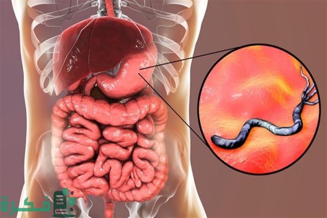 متى تختفي أعراض جرثومة المعدة النفسية