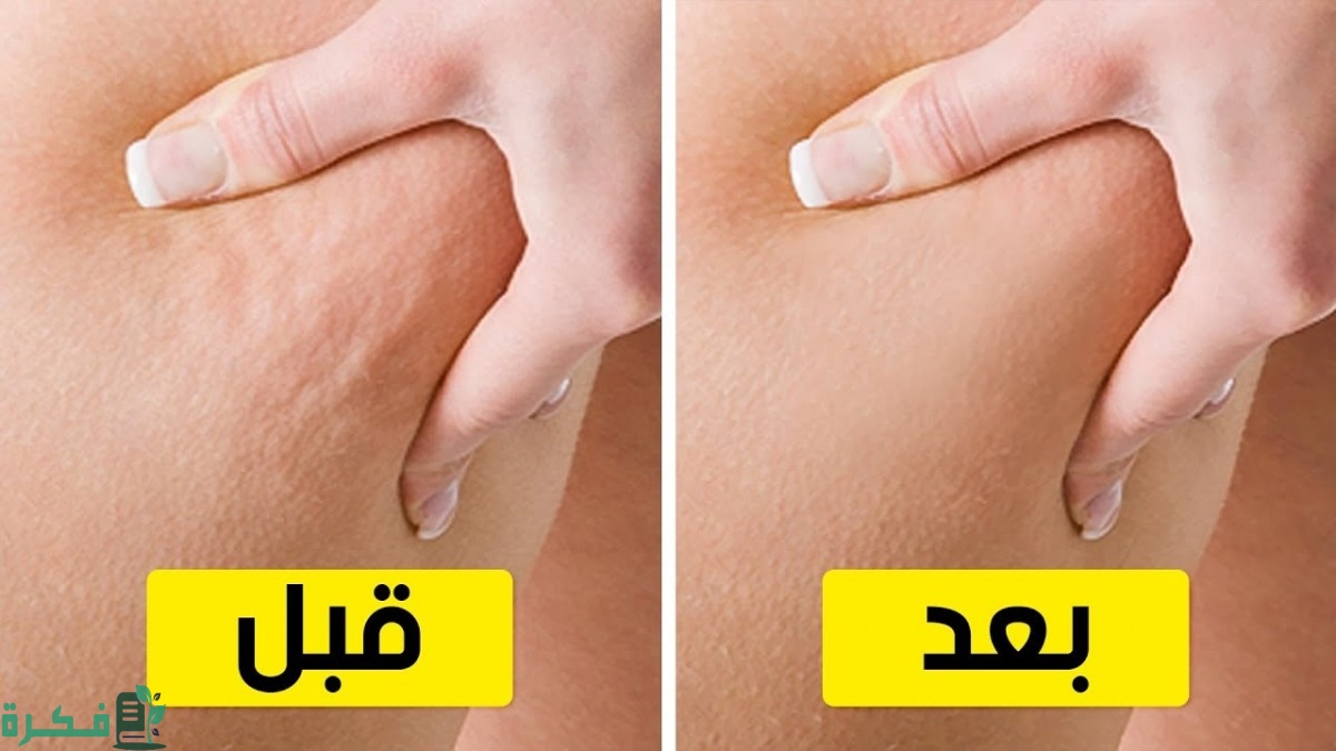 وصفات لإزالة السيلوليت من الأرداف