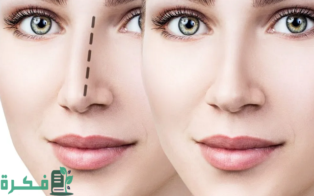 ترتيب الدول العربية من حيث عمليات التجميل 2 ترتيب الدول العربية في عمليات التجميل