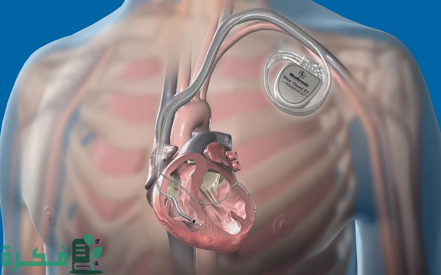 سعر جهاز تنظيم ضربات القلب في قطر