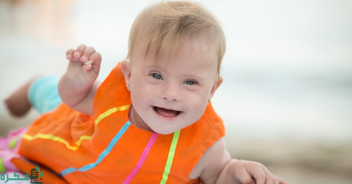 نموذج دراسة حالة متلازمة داون