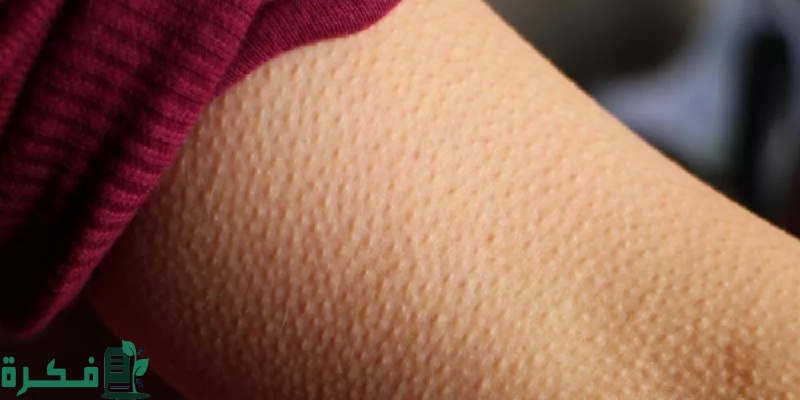 الفرق بين جلد الوزة والشعر تحت الجلد