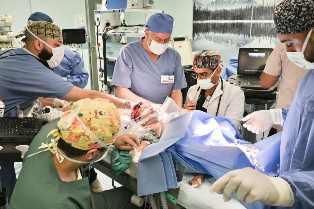 السعودية تتصدر العالم في إجراء عمليات فصل التوائم السيامية